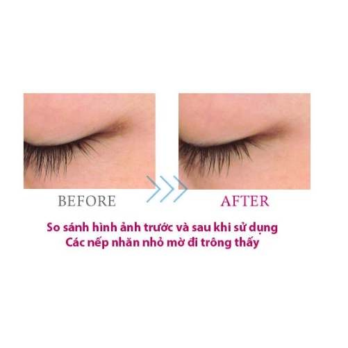 Kem dưỡng trắng vùng mắt Meishoku Placewhiter eye cream 30g