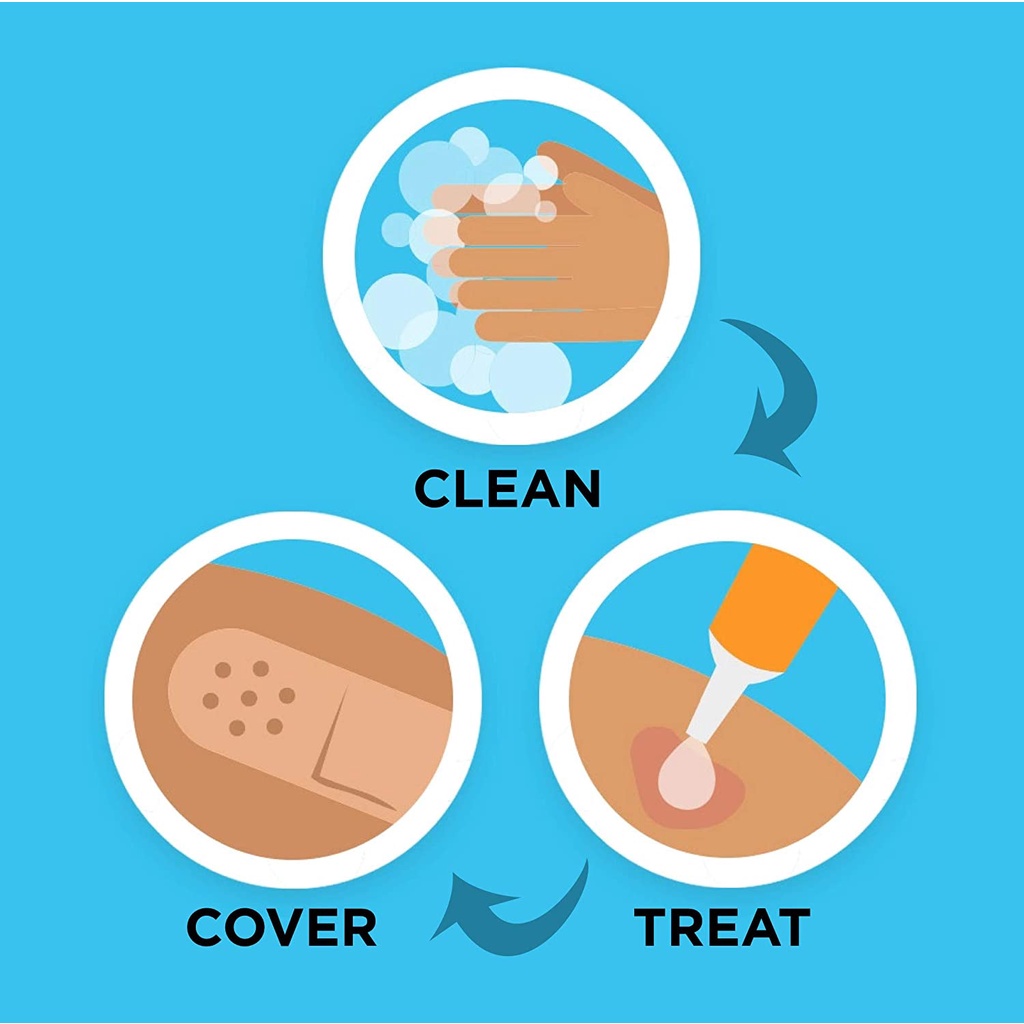 Kem mỡ sát khuẩn và giảm sẹo Neosporin Original Oitment