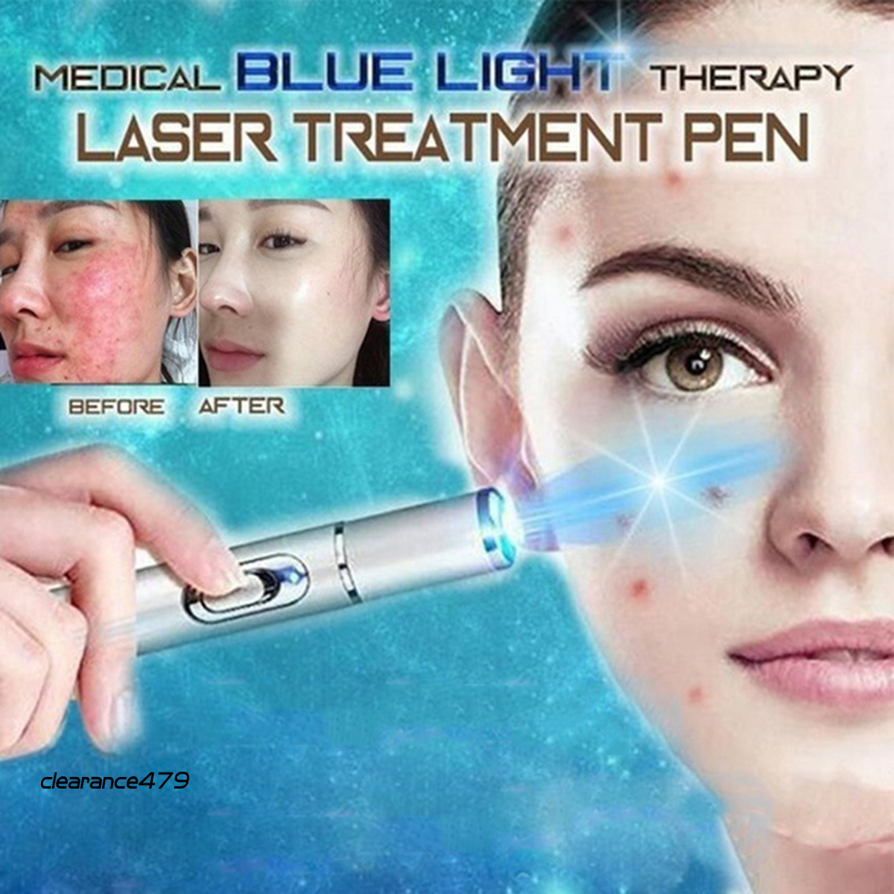 (Hàng Mới Về) Bút Laser Trị Mụn / Tàn Nhang / Vết Thâm Sử Dụng Công Nghệ Ánh Sáng Xanh Lam 479