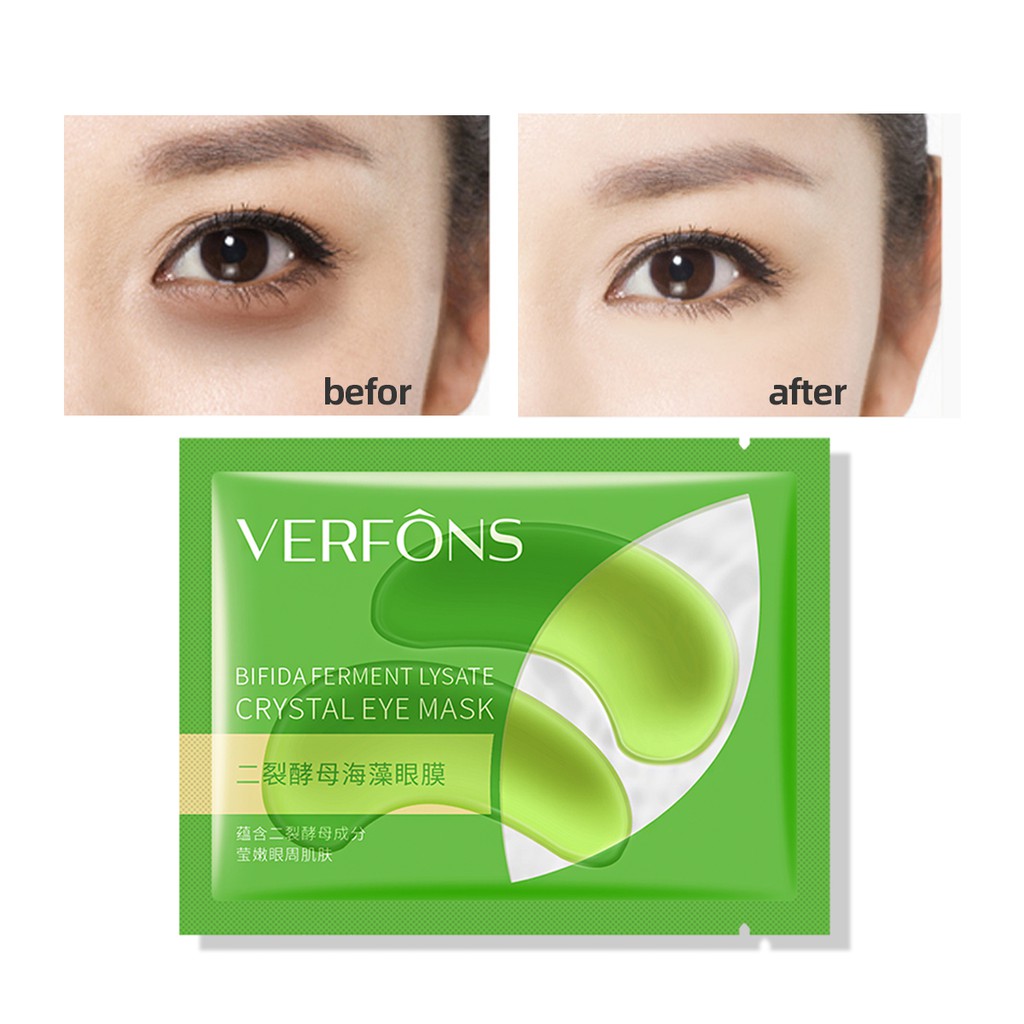 Mặt Nạ Mắt HengFang Ffs96067 Dưỡng Ẩm Chống Lão Hóa Hiệu Quả 7.5g | BigBuy360 - bigbuy360.vn