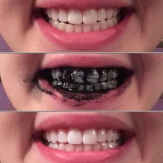 BỘT THAN TRE HOẠT TÍNH TRẮNG RĂNG CAO CẤP ZENPALI ( Tặng 1tuyp kem đánh răng SENSODYNE )