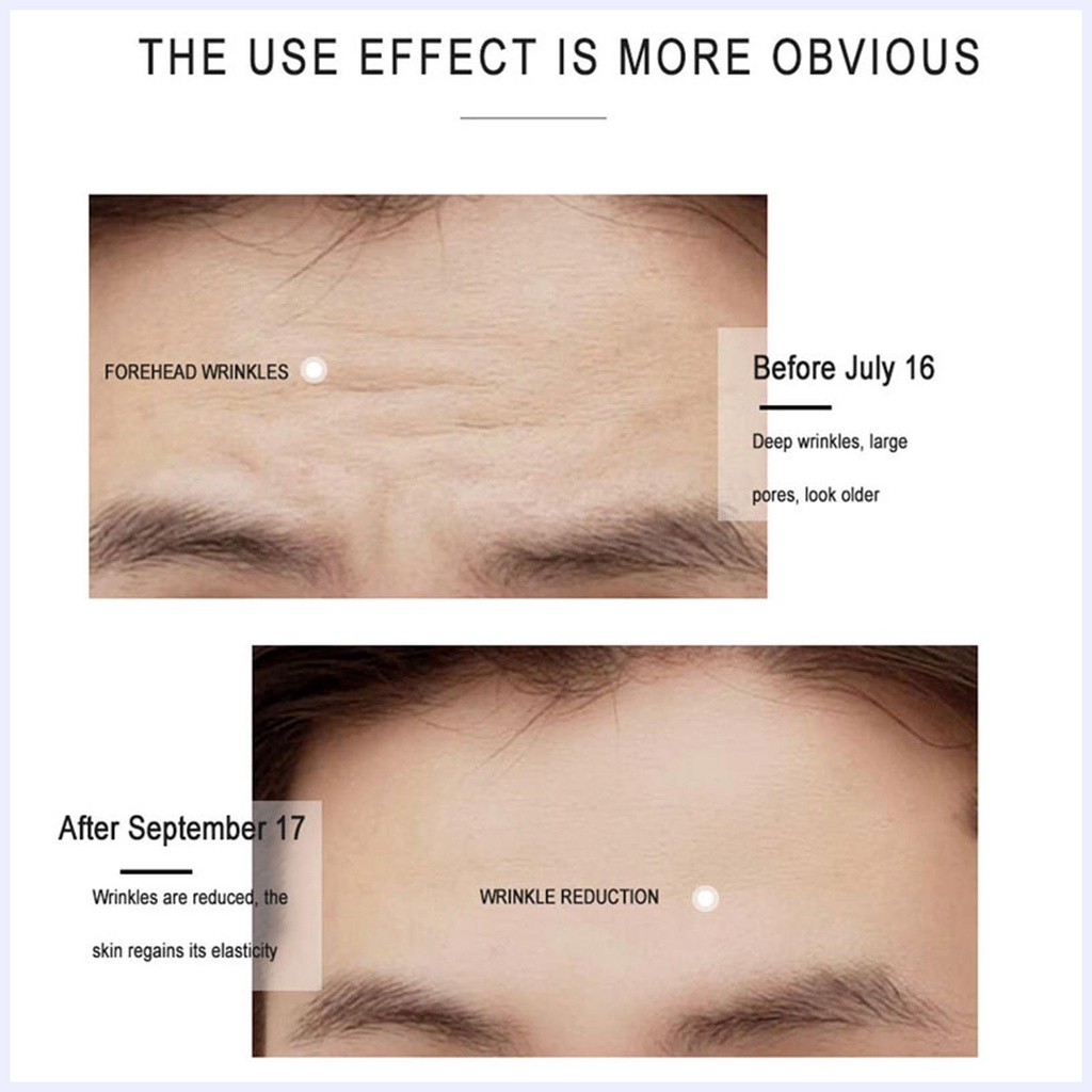 Serum Retinol 2.5 Retinol Chống Lão Hóa Se Khít Lỗ Chân Lông Làm Mờ Vết Thâm Làm Sáng Da
