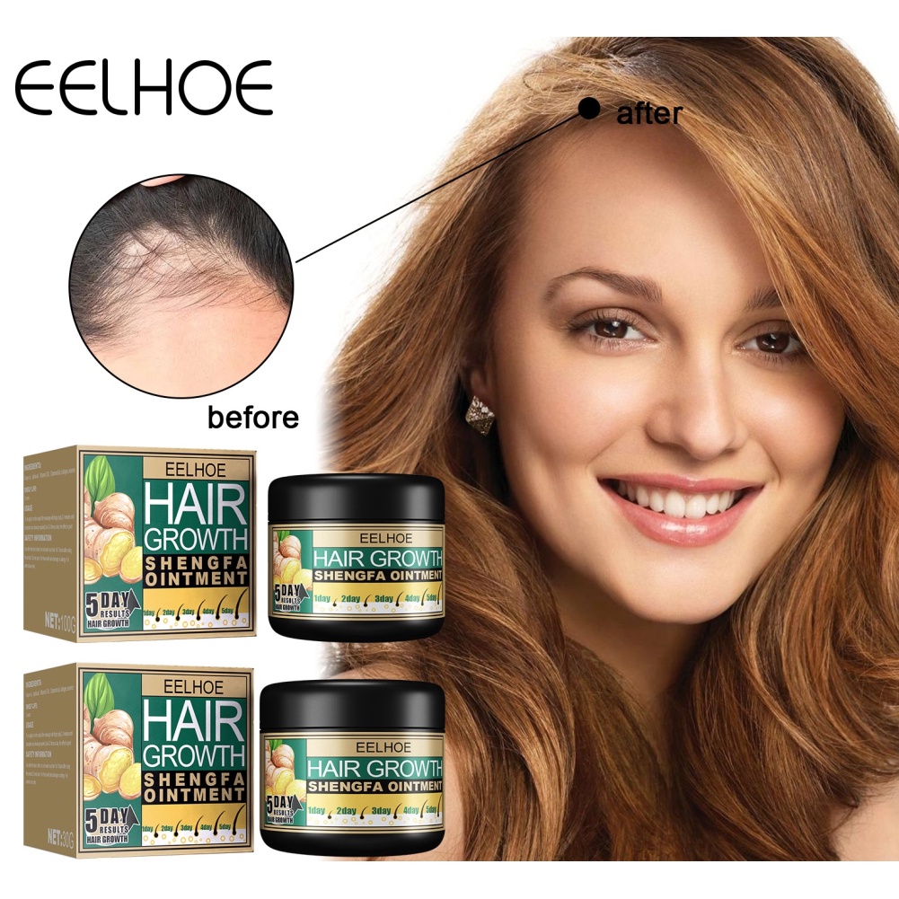 Eelhoe Kem Nảy Mầm  -rốc 30Ml Kem Phục Hồi Tóc-Ampere
