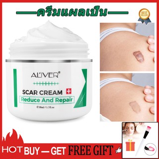 (🎁 Freebie) ALIVER Repair Scar Loại bỏ vết rạn da Scald Caesarean Bump Phẫu thuật Scar