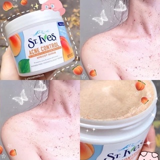 TẨY DA CHẾT BODY ST.IVES