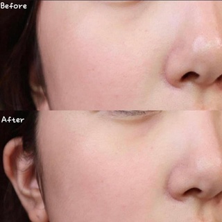 Serum The Ordinary AHA 30% + BHA 2% Peeling Solution