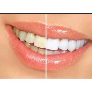 Kem đánh răng SENSODYNE thái