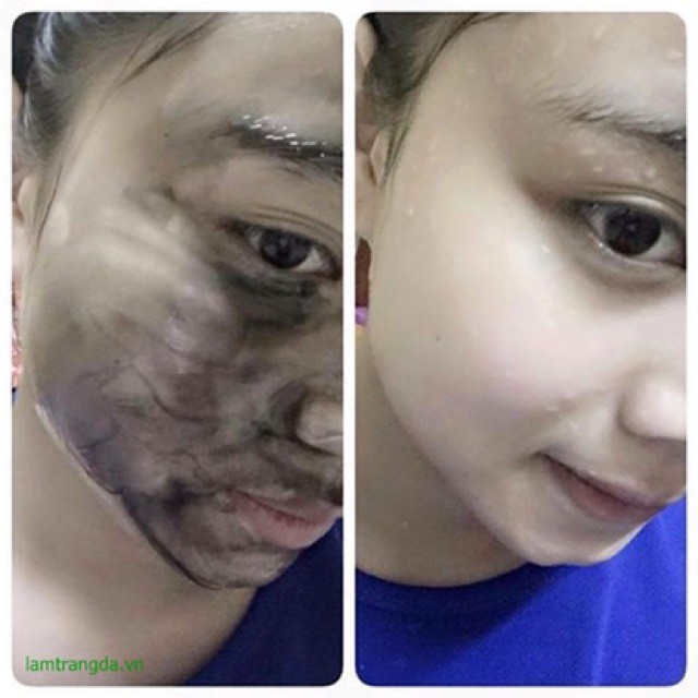 Mặt nạ thải độc than tre,hút chì, trắng da... (Hàng mới về) Hàng Mới Cập Nhập | Thế Giới Skin Care