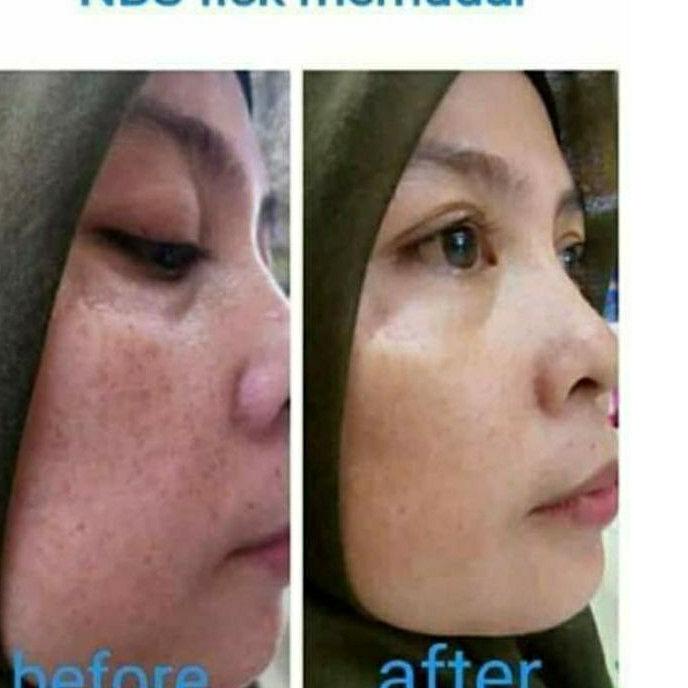 Cái thứ hai này! Tấm trải giường phun sương làm đẹp Lr075 Natura NBS Beuty Biuty Sprey Natura | BigBuy360 - bigbuy360.vn