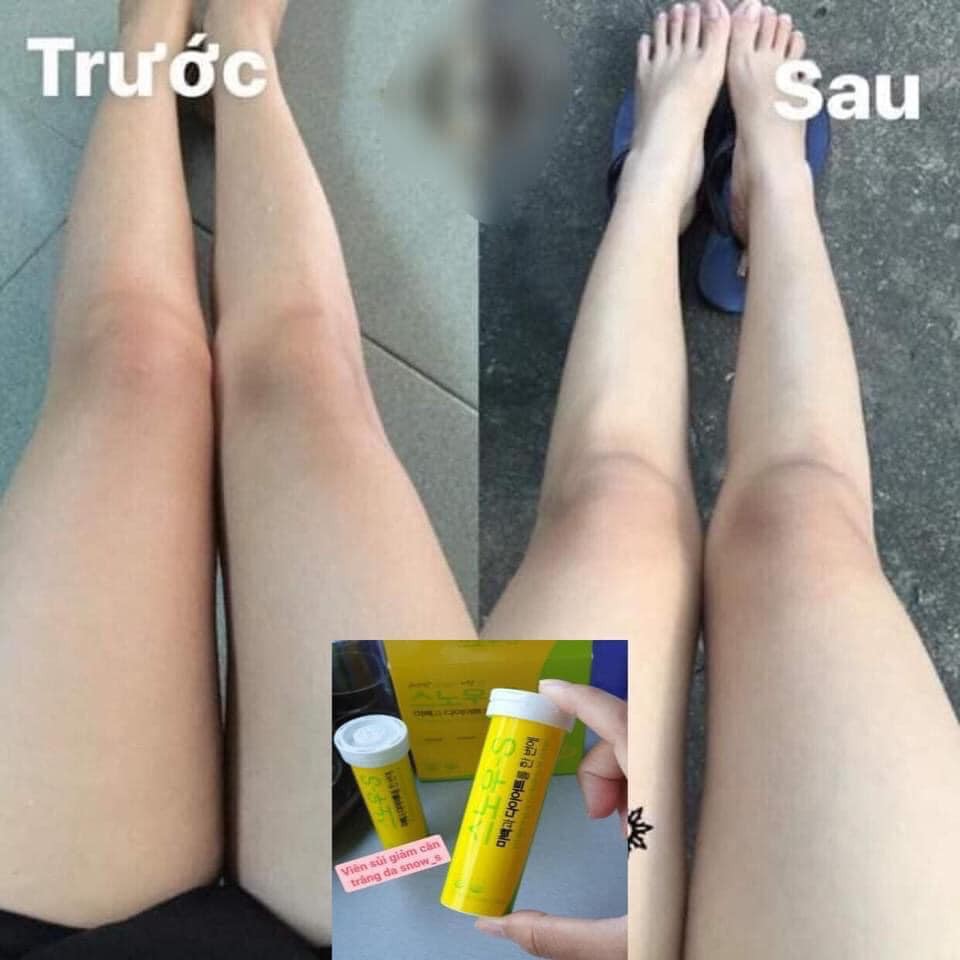 VIÊN SỦI GIẢM CÂN - TRẮNG DA SNOW S HÀN QUỐC | BigBuy360 - bigbuy360.vn