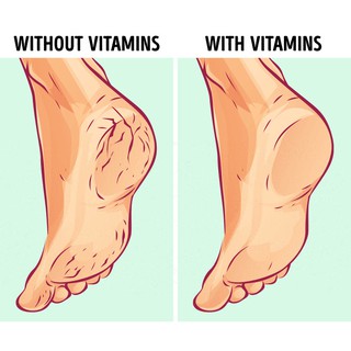 Kem nứt gót chân Kpem của nga