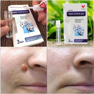 Gel tẩy nốt ruồi mụn cóc mụn thịt mụn