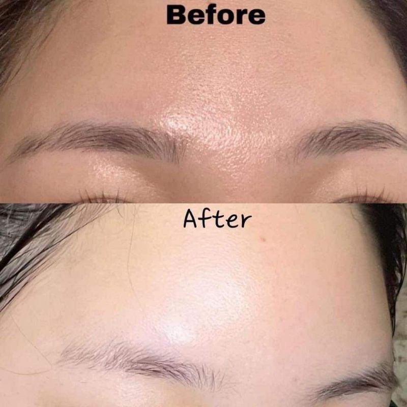 Serum dưỡng trắng Niacinamide 20% Lumiderm