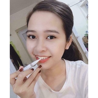 Bút tẩy trắng răng Dazzling White