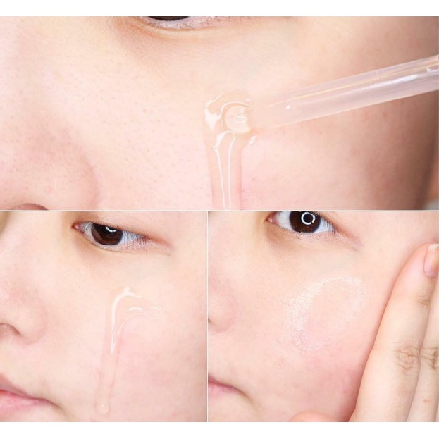 Serum B5 Hydra Goodndoc Phục Hồi Dưỡng Trắng Da Hàn Quốc | BigBuy360 - bigbuy360.vn