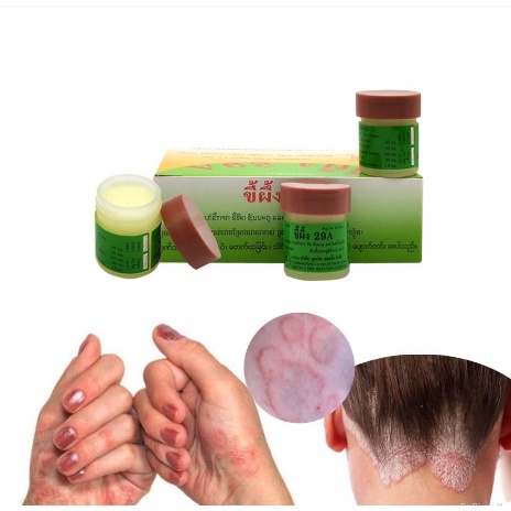 Hủ kem 29A Bôi Ngoài Da Nấm Lang Ben chính hãng Thái Lan 7,5gr