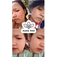 SERUM PEEL NHÂN SÂM HANA MISS