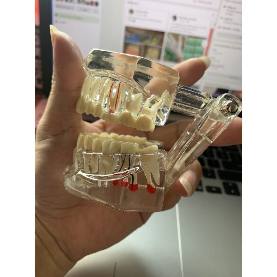 [Hàng mới về] Mô hình hàm răng đa năng chuyên dụng dành cho nha khoa