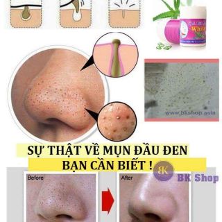Gel hút mụn white