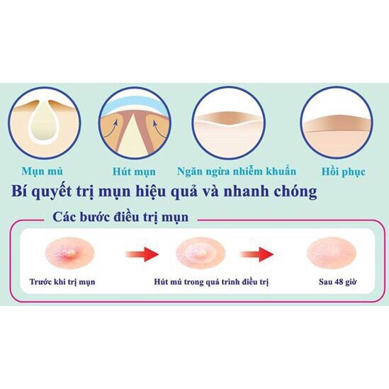 Miếng dán mụn Mayan Care chính hãng 24 miếng