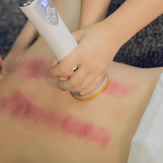 Thiết bị Cạo gió massage nhiệt RF
