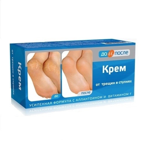Kem bôi nẻ, nứt gót chân, dưỡng mềm mịn gót chân Kpem Nga 50ml - Nhà thuốc An Đức