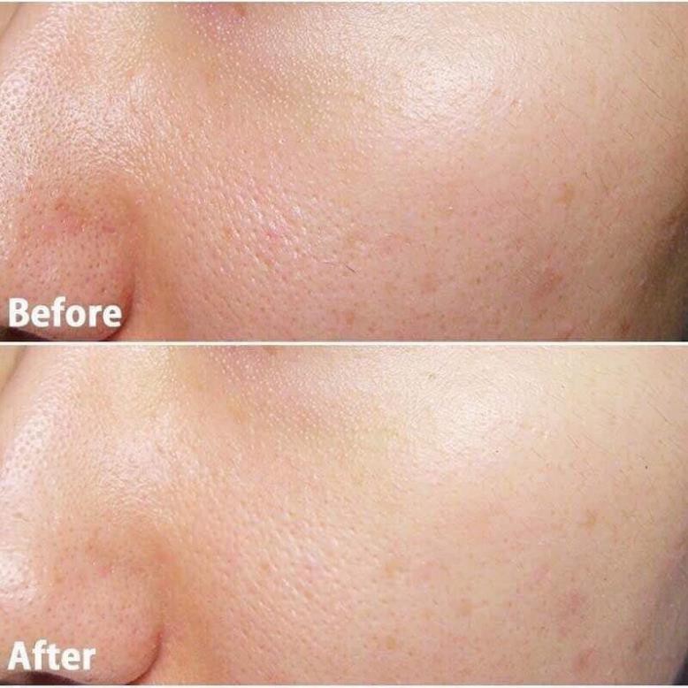Sữa Rửa Mặt La Roche-Posay Effaclar Purifying Foaming Gel Cleanser Minisize 50ml