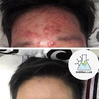 [SALE] bột diếp cá gói lớn
