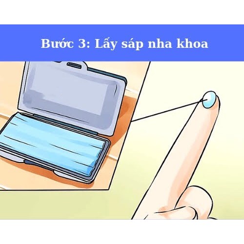 Sáp nha khoa, sáp chỉnh nha 3M, Dental Wax 3M