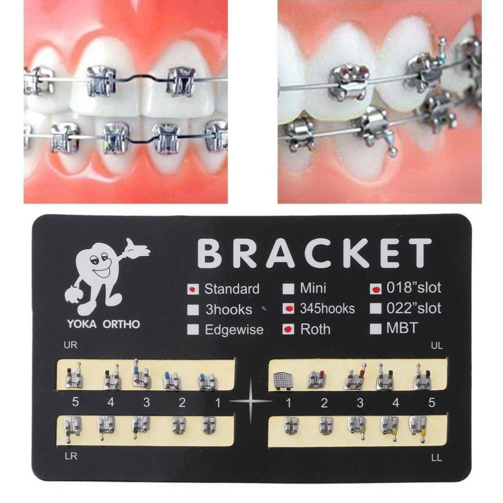 Mắc cài kim loại chỉnh nha, mắc cài bao giấy