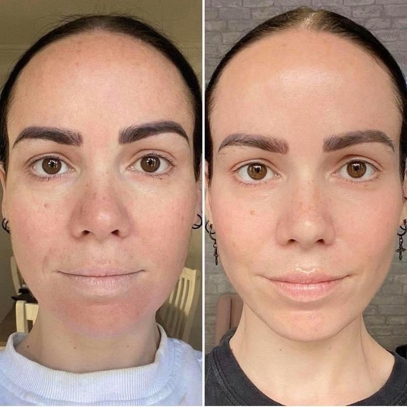 Kem giảm nám cao cấp Mesoestetic cosmelan 2