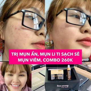 [Chín hãng] Combo kem face và serum mụn Soo Young