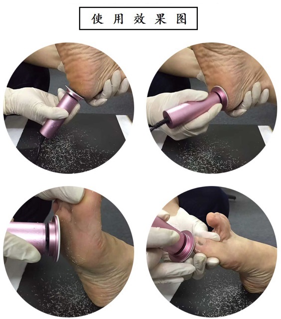 Máy chà gót chân tặng kem 60 miếng chà