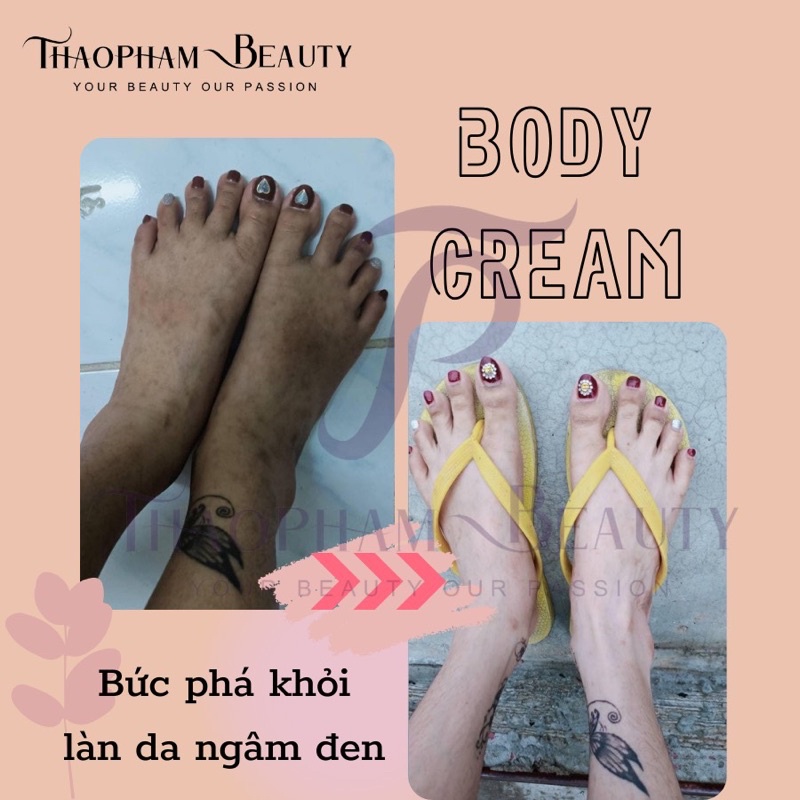 |GÓI SIÊU TIẾT KIỆM| COMBO SIÊU KÍCH TRẮNG MỜ THÂM CAO CẤP