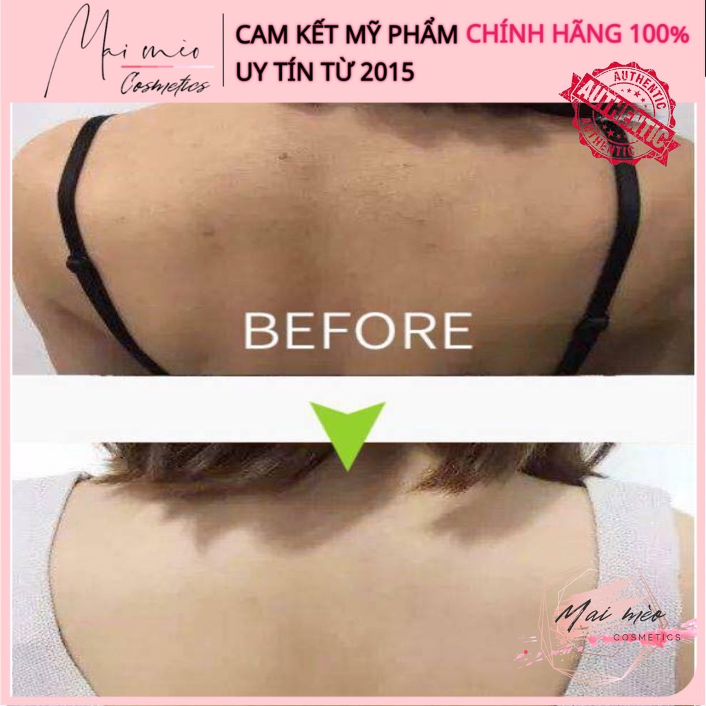 Xà phòng For Back ngừa mụn lưng Nhật Bản