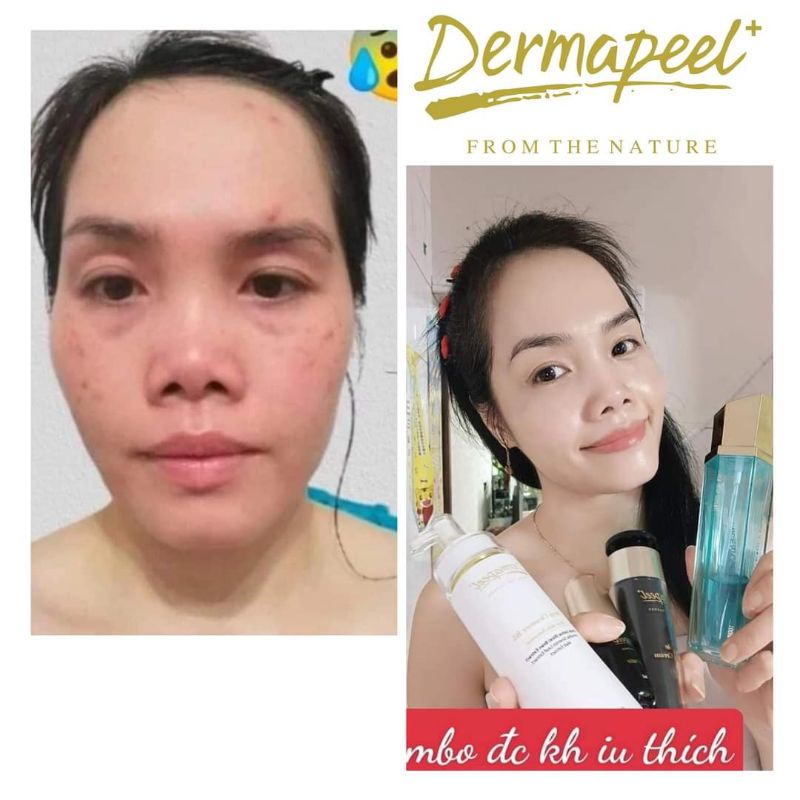 SỮA RỬA MẶT DERMAPEEL