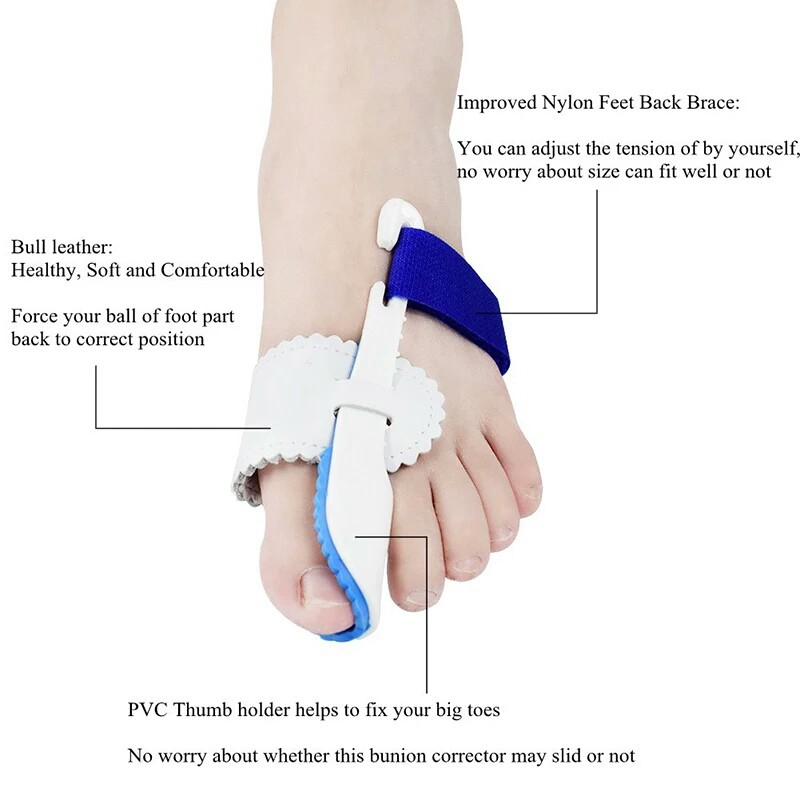Dụng cụ nẹp định hình ngón chân cái