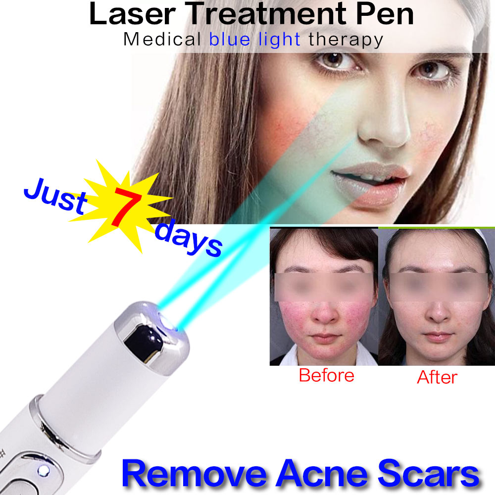 [Hàng mới về] Bút laser ánh sáng xanh giúp giảm mụn xóa mờ nếp nhăn Kd-7910