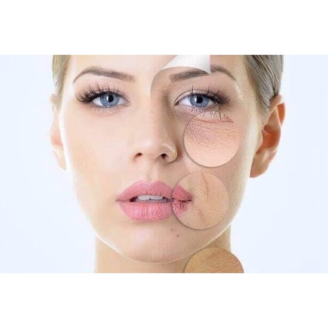 Lời khen ngợi đáng giá KEM GIẢM NHĂN, NÂNG CƠ NỔI TIẾNG NHẤT CỦA MANUKA