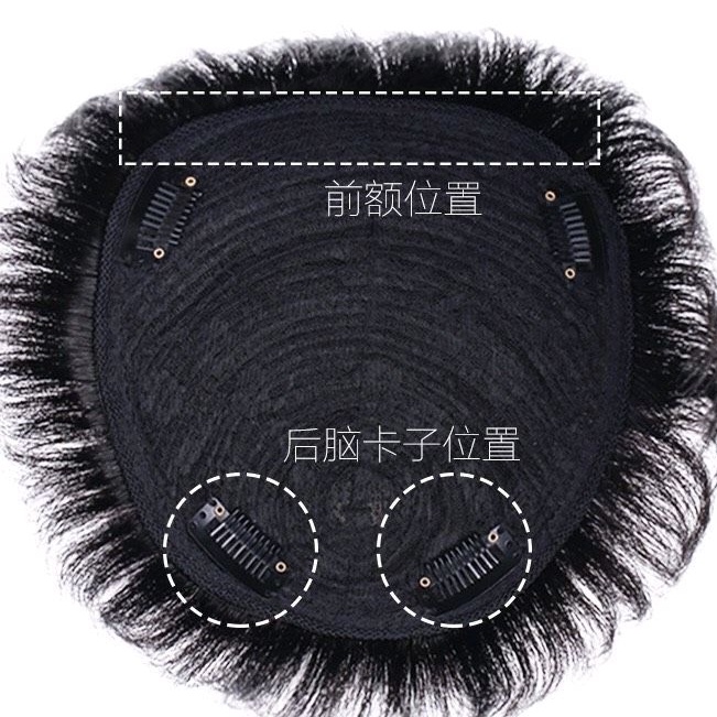 Tóc Giả Che Hói Cho Nam Phong Cách Trẻ Trung Hamin