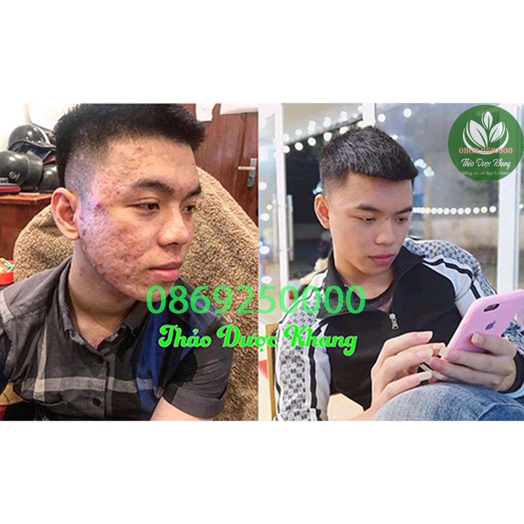 Combo Thảo Dược Khang Serum 30ml Và Bột Thảo Dược