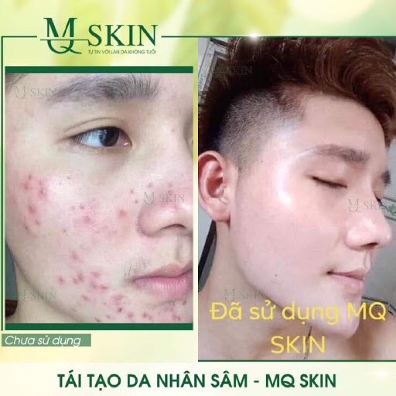 [Chính Hãng]Serum Tái Tạo Da Nhân Sâm MQ SKIN