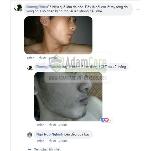 Bột LCLT hỗ trợ mọc râu tóc