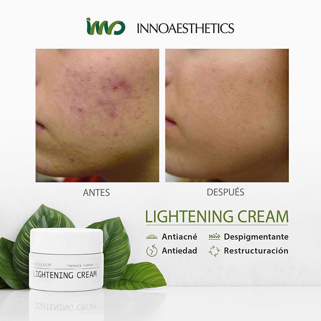 HÀNG CÔNG TY - Hoạt Chất Vitamin A 5% Innoaesthetics Inno LIGHTENING Tái Tạo Đều Màu Da Giảm Mụn Thâm Mụn Cả Da Mỏng Yếu