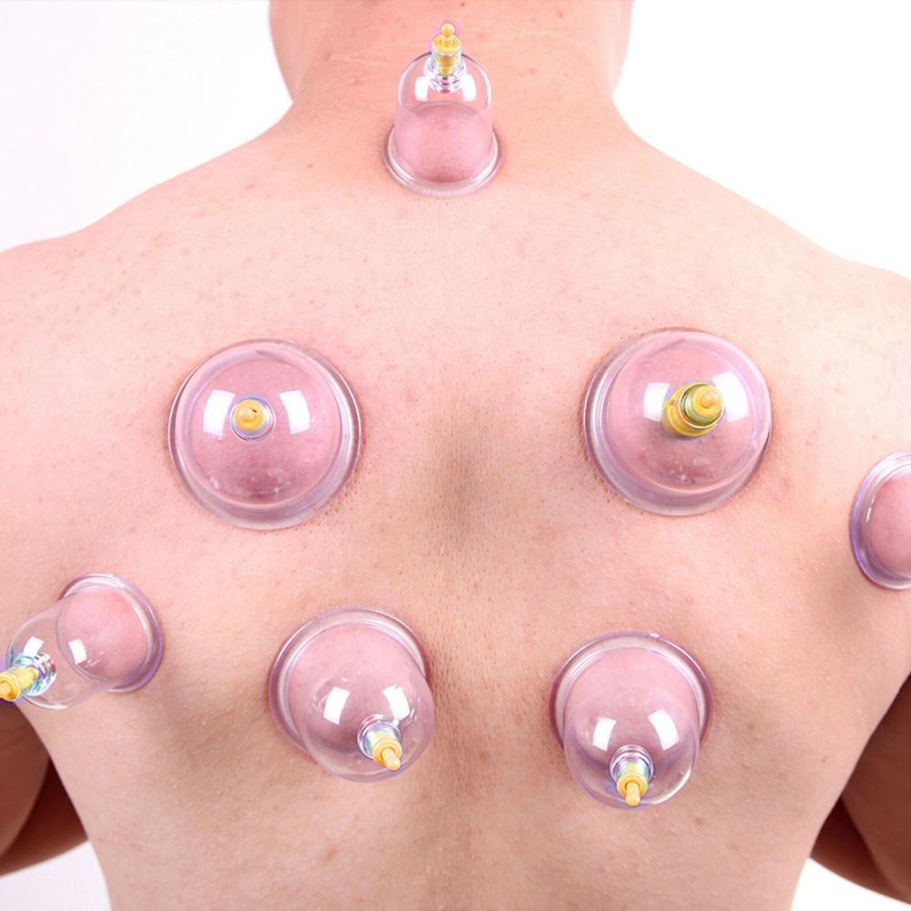 DYRUIDOJ Set 12 / 24 / 32 Dụng Cụ Châm Cứu Mát Xa Cơ Thể