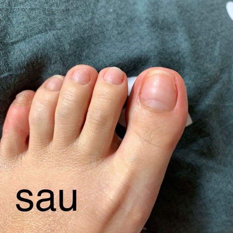 [HÀNG CHÍNH HÃNG] Dưỡng móng CND
