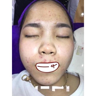 Serum Sâm tố nữ - serum sâm huyền phi