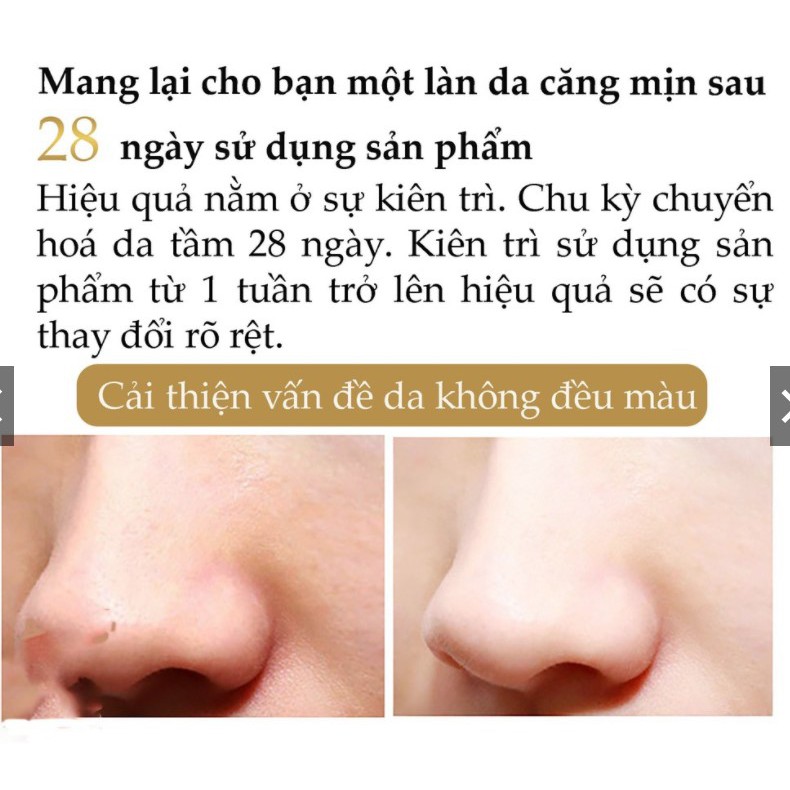 [CHÍNH HÃNG 100%] YiYan Kem Che Khuyết Điểm Dưỡng Da Cấp Ẩm Cải Thiện Thâm Tối Da 30g