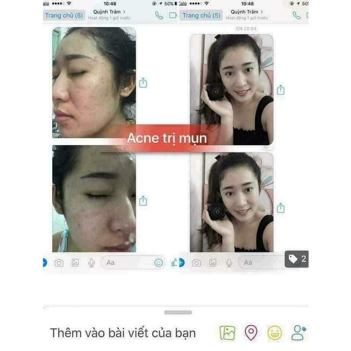 Kem mụn Acnes dưỡng trắng mịn da, hổ trợ giảm mụn 30g - Dr Cell