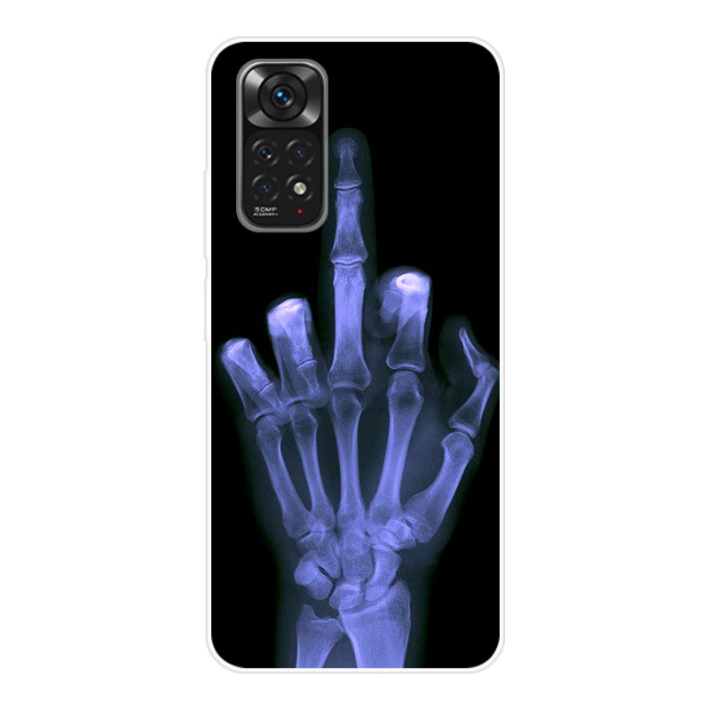 Ốp Điện Thoại TPU Dẻo Họa Tiết Hoạt Hình Dễ Thương Cho Xiaomi Redmi Note 11 Redmi Note 11s Note11